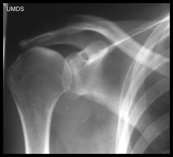 Case 69 – Figure 2 – Scottish Radiological Society